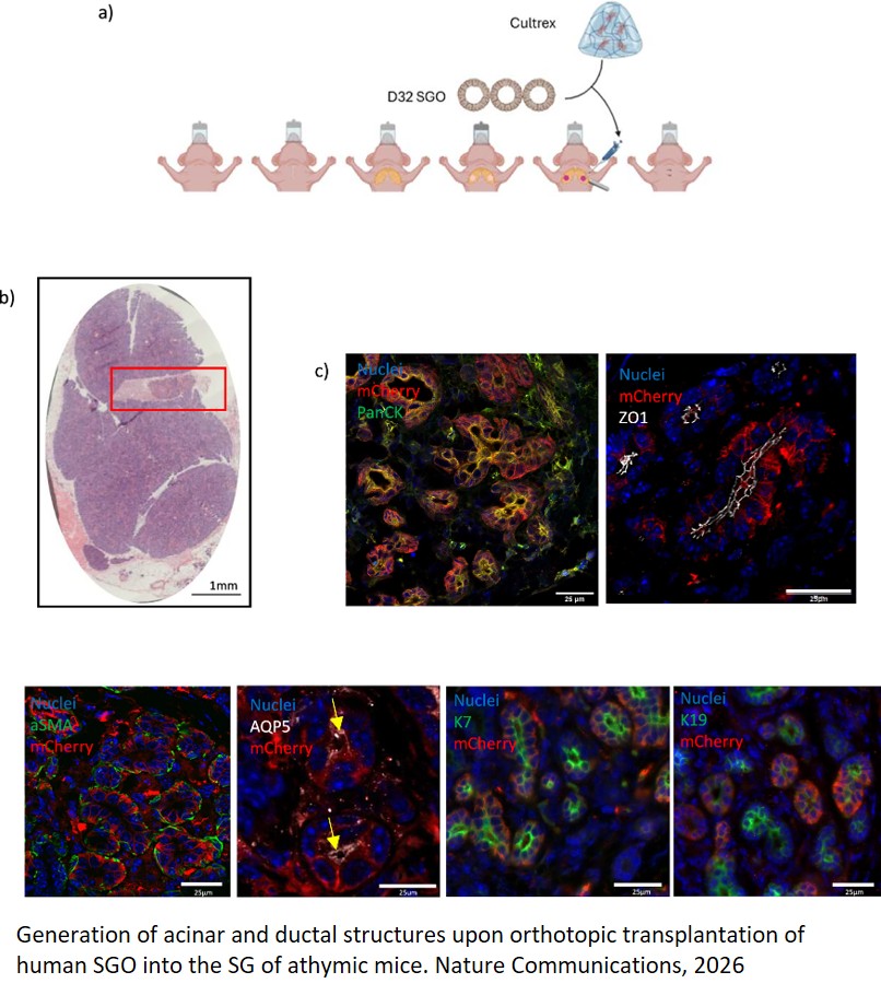 Development-inspired approach for the derivation of functional and transplantable salivary gland organoids from human pluripotent stem cells