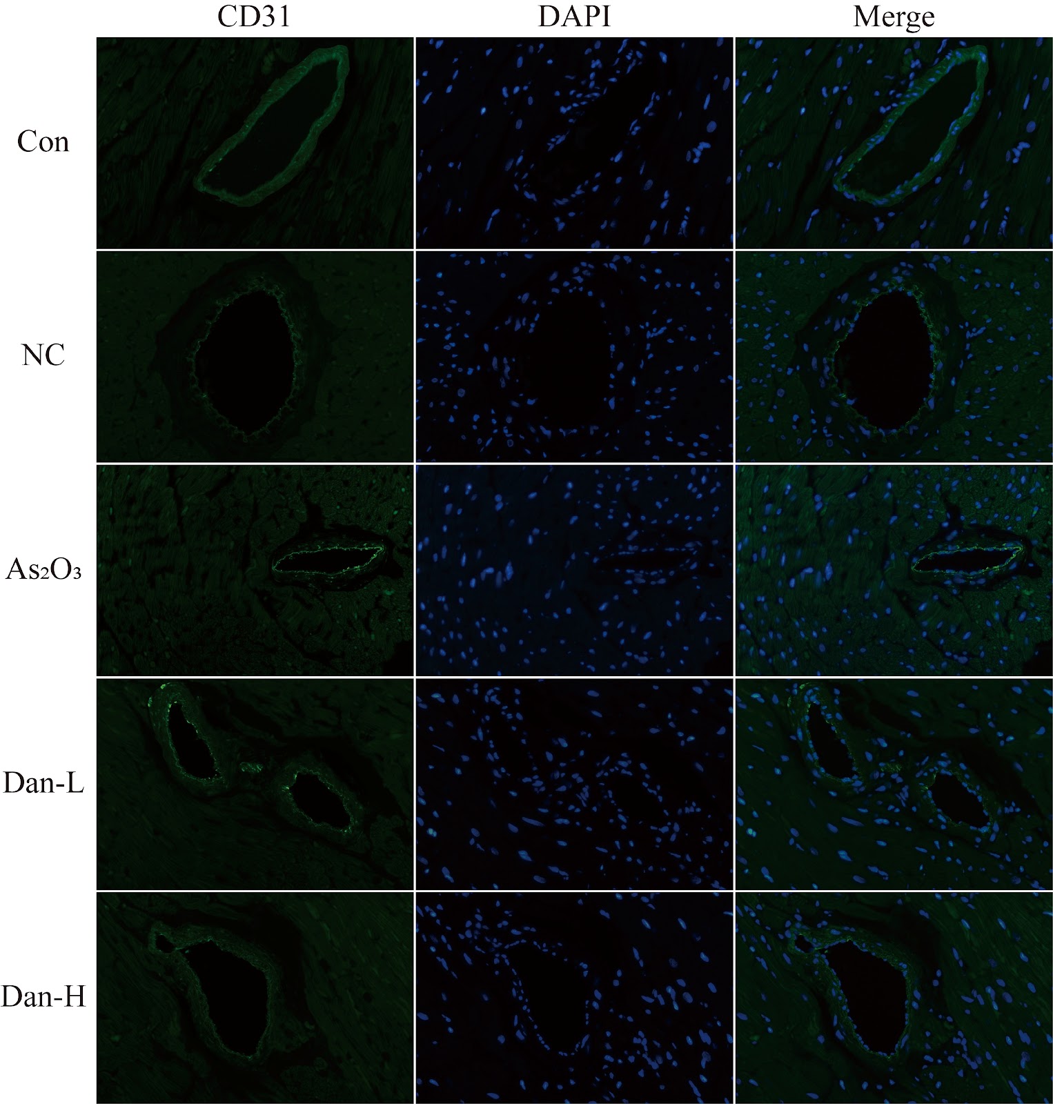 Investigation of the cardioprotective potential of dantrolene in mitigating arsenic-induced cardiac dysfunction in rats