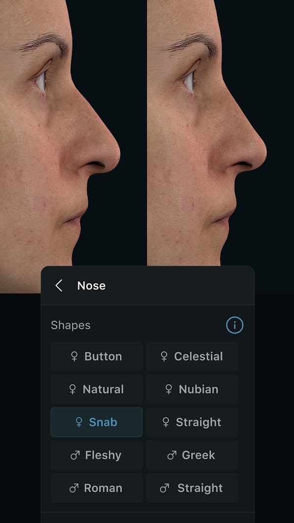 Simulation 3D des visages dans l’application Crisalix avec l’outil de procédure « Nose » ouvert. 1080px x 1920px.