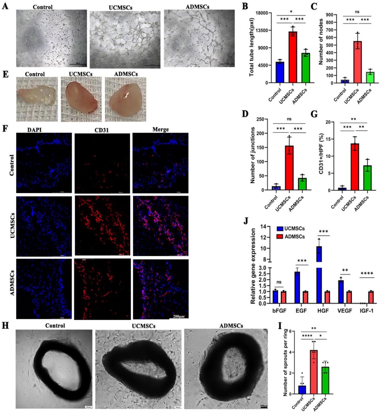The therapeutic efficacy comparison of MSCs derived different tissues unveilings anti-apoptosis more crucial than angiogenesis in treating acute myocardial infarction