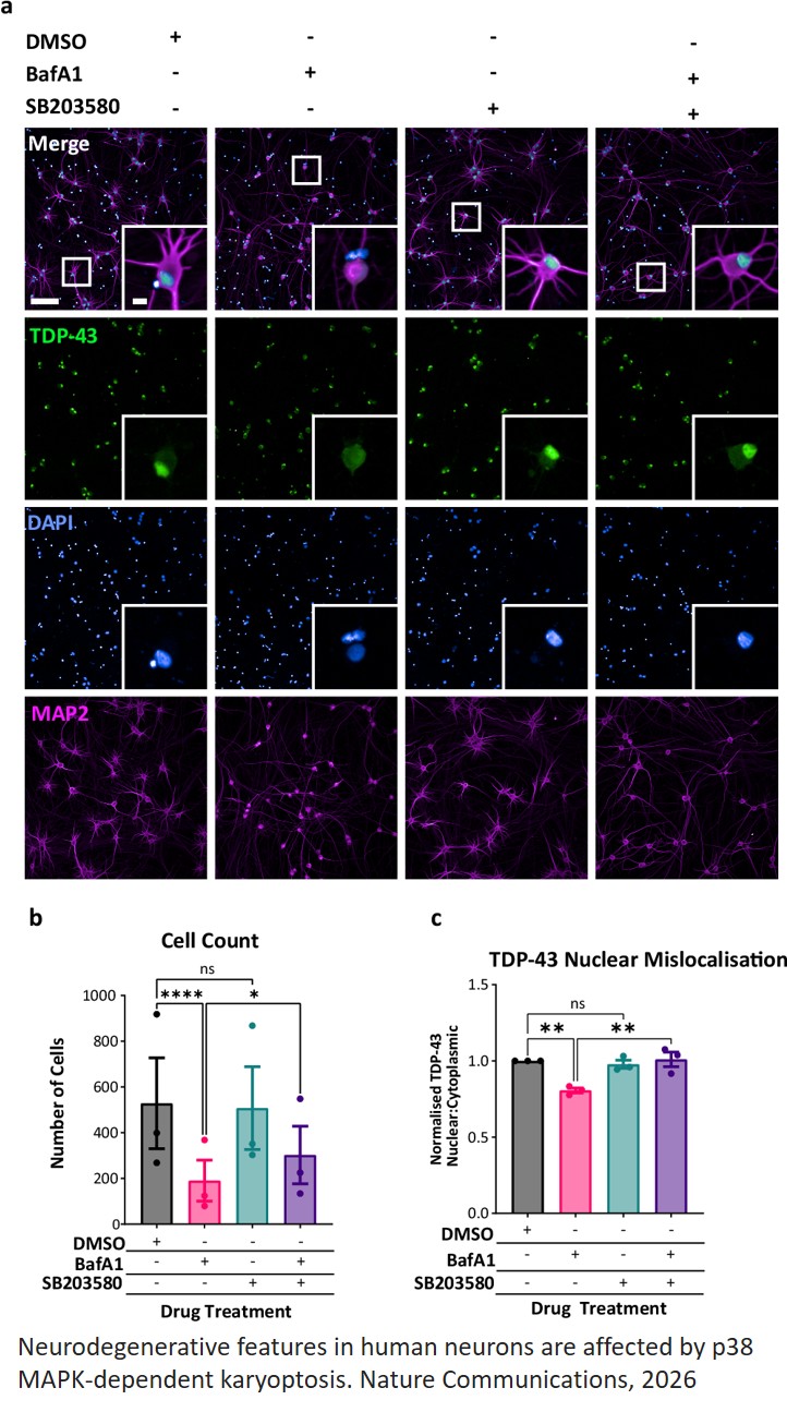 Karyoptosis mediates cell death and neurodegeneration upon proteotoxic stress