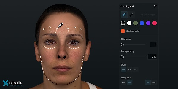 Simulation 3D des visages dans l’application Crisalix avec l’outil « Dessin » ouvert. 2400px x 1200px.