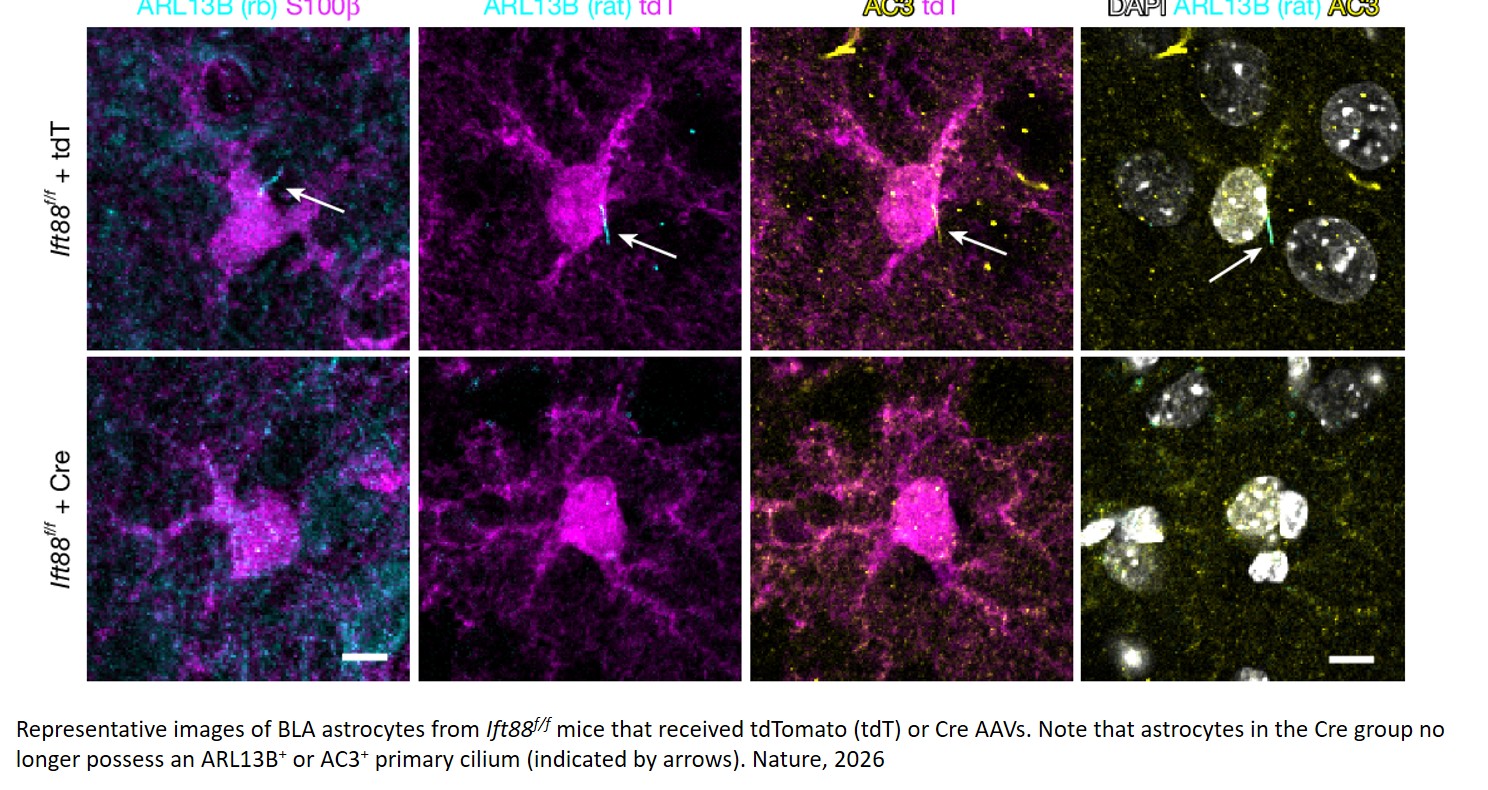Amygdala astrocyte primary cilium mechanisms contribute to stress behaviours