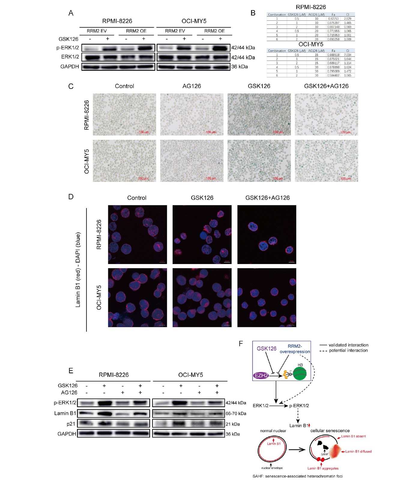 EZH2 inhibition induces senescence via ERK1/2 signaling pathway in multiple myeloma