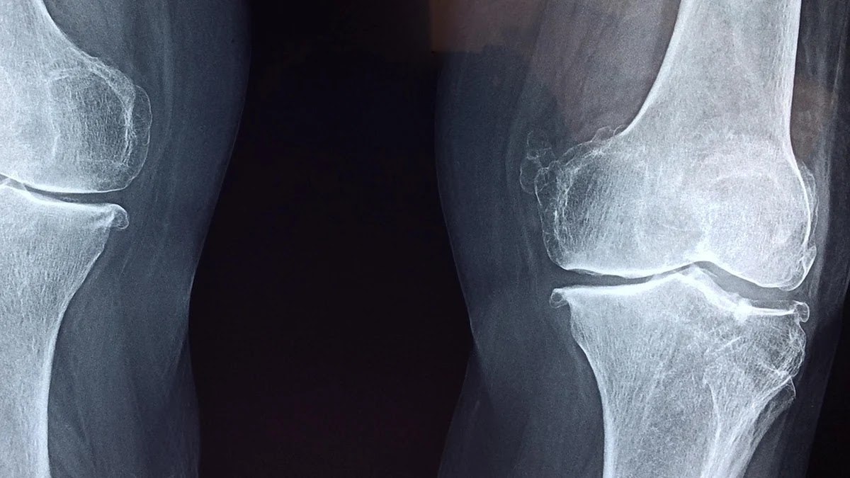 불면증인지행동치료 과정과 효과 비교