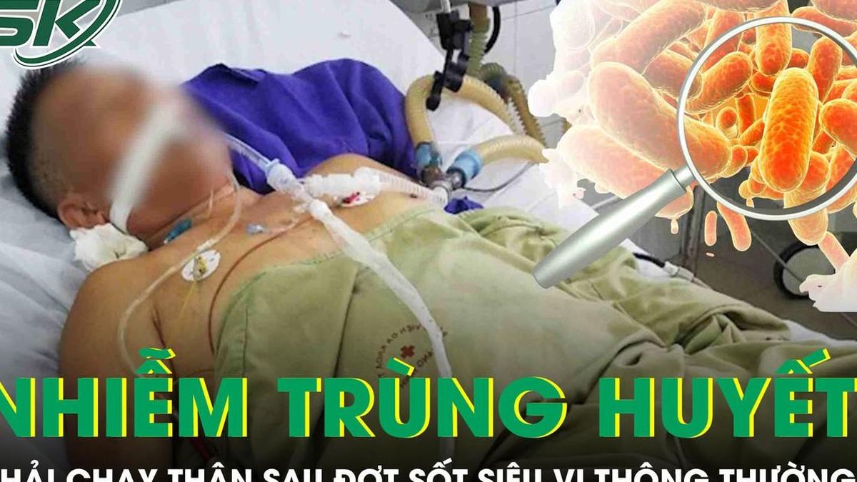 Người đàn ông bất ngờ nhiễm trùng huyết phải chạy thận sau đợt sốt siêu vi - Báo Sức Khỏe &amp; Đời Sống