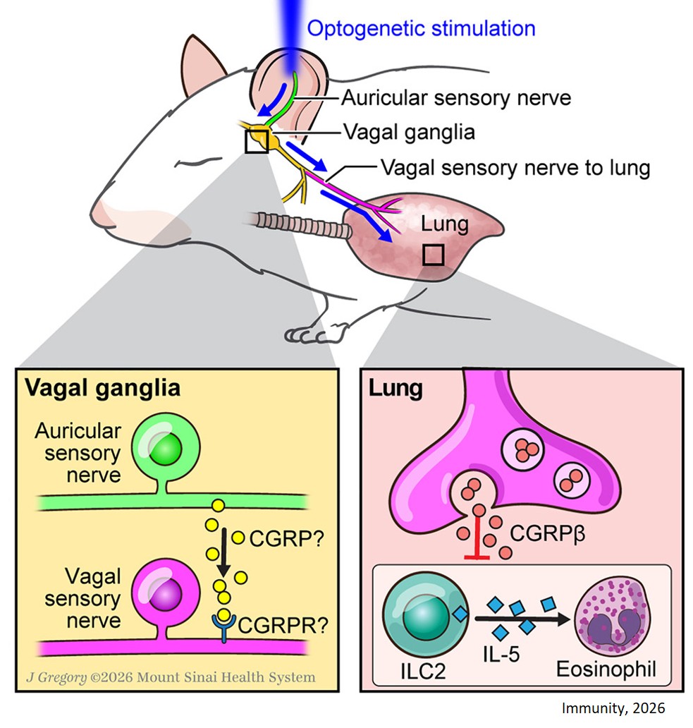 Activation of the auricular vagus nerve reflex suppresses airway inflammation