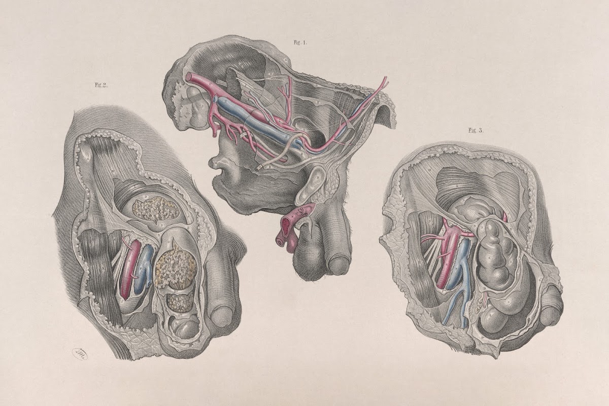 Surgical anatomy Pl32 1856