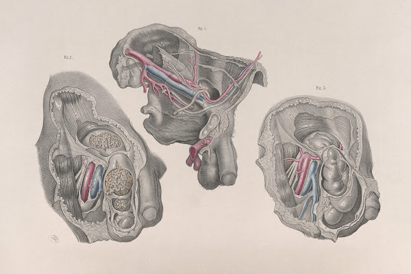 Surgical anatomy Pl32 1856