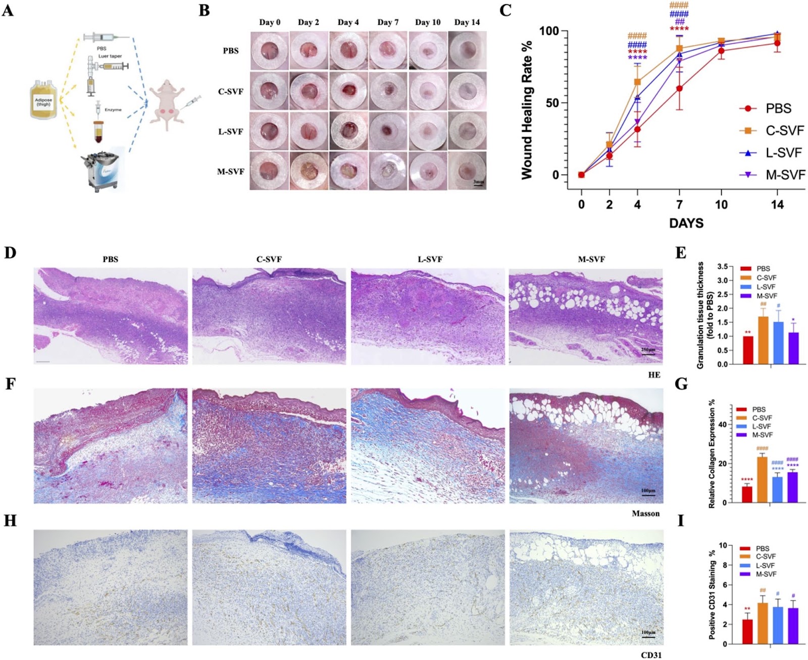 Therapeatic evaluation and single cell analysis of adipose stromal vascular fraction isolation from a commercial cell separation system