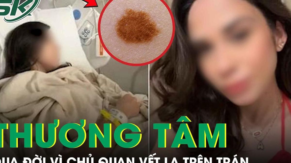 Cô gái 26 tuổi qua đời thương tâm vì chủ quan vết lạ trên trán - Báo Sức Khỏe &amp; Đời Sống