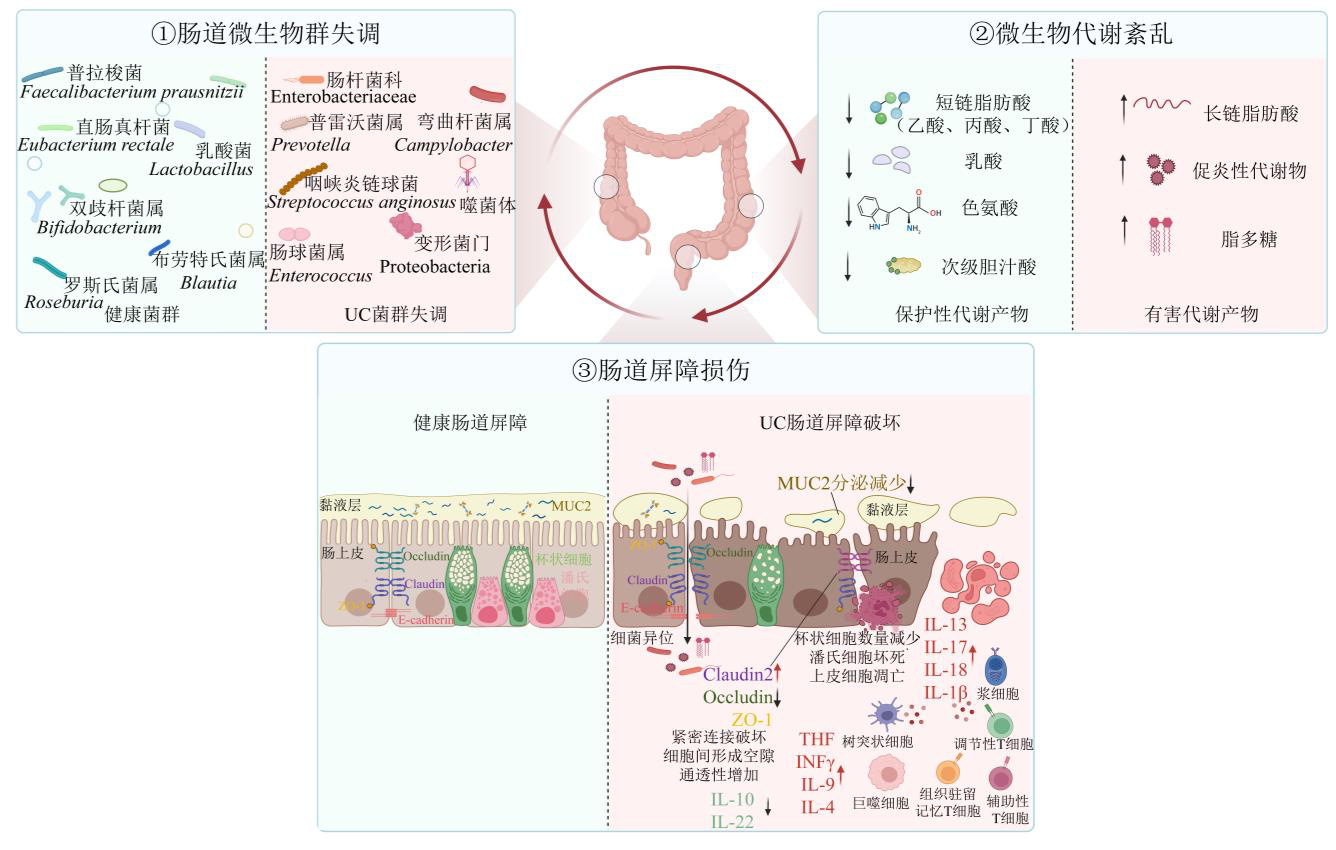 Research Progress on the Role of Gut Microbiota–Intestinal Barrier Interaction in Ulcerative Colitis and Traditional Chinese Medicine Intervention