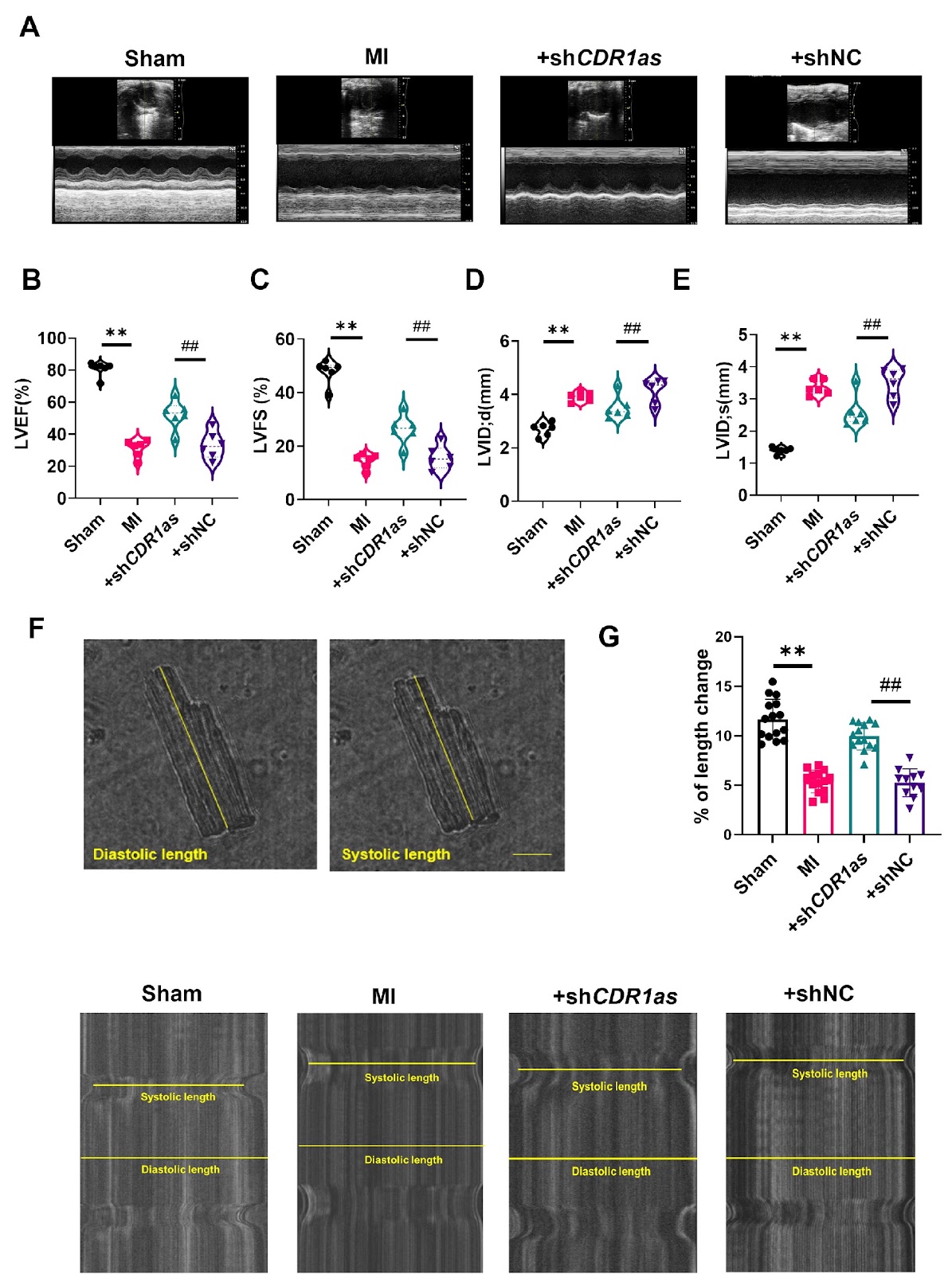 CDR1as modulates arrhythmia post-myocardial infarction via regulating Cav1.2