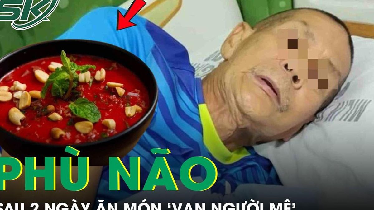 Người đàn ông phù não sau 2 ngày ăn món 'vạn người mê' - Báo Sức Khỏe &amp; Đời Sống