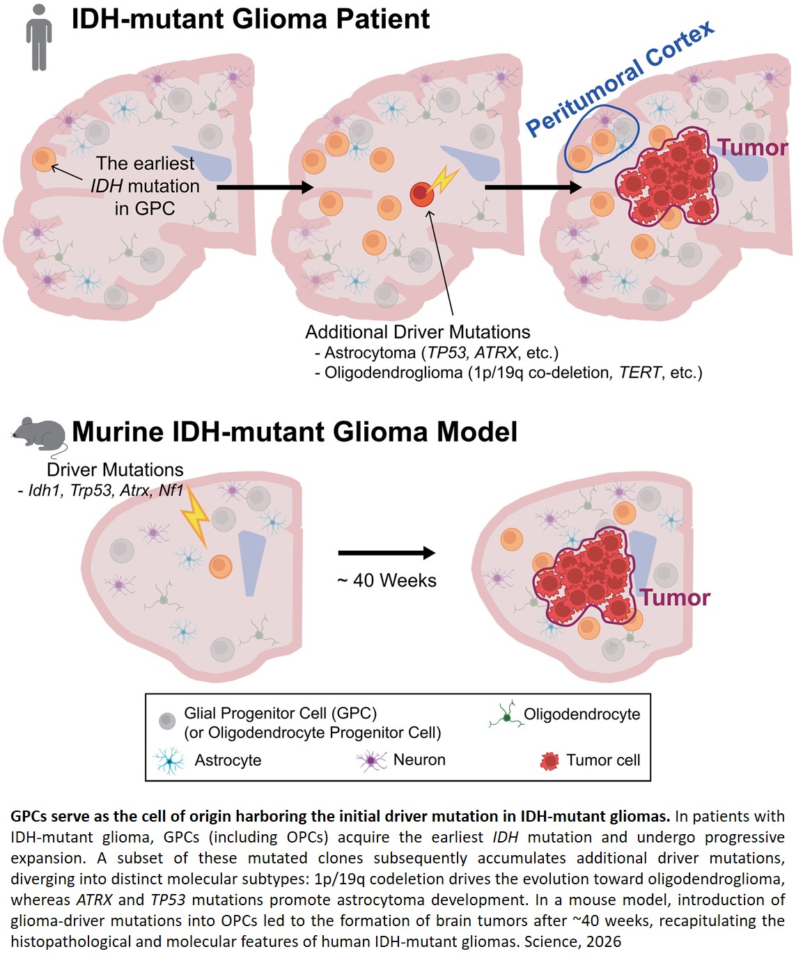Origin cells for malignant brain tumor identified