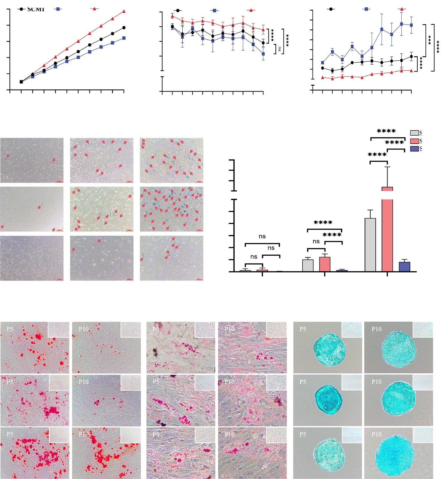 Evaluation of the impact of customized serum-free culture medium on the production of clinical-grade human umbilical cord mesenchymal stem cells: insights for future clinical applications