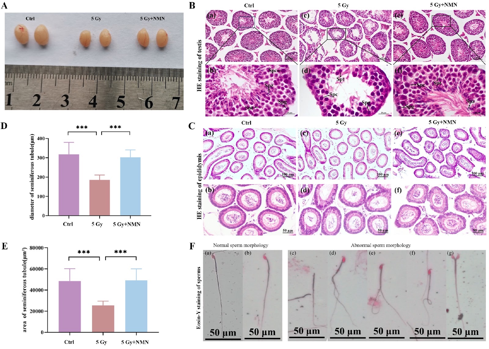 Nicotinamide mononucleotide ameliorates ionizing radiation-induced spermatogenic dysfunction in mice by modulating the glycolytic pathway