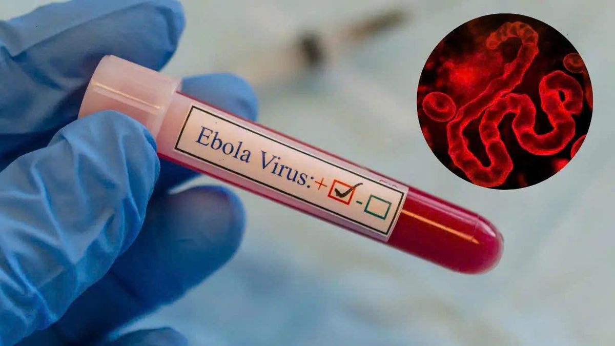 Bộ Y tế vừa phát công điện hỏa tốc về Ebola - Tạp chí Kinh Tế Sài Gòn