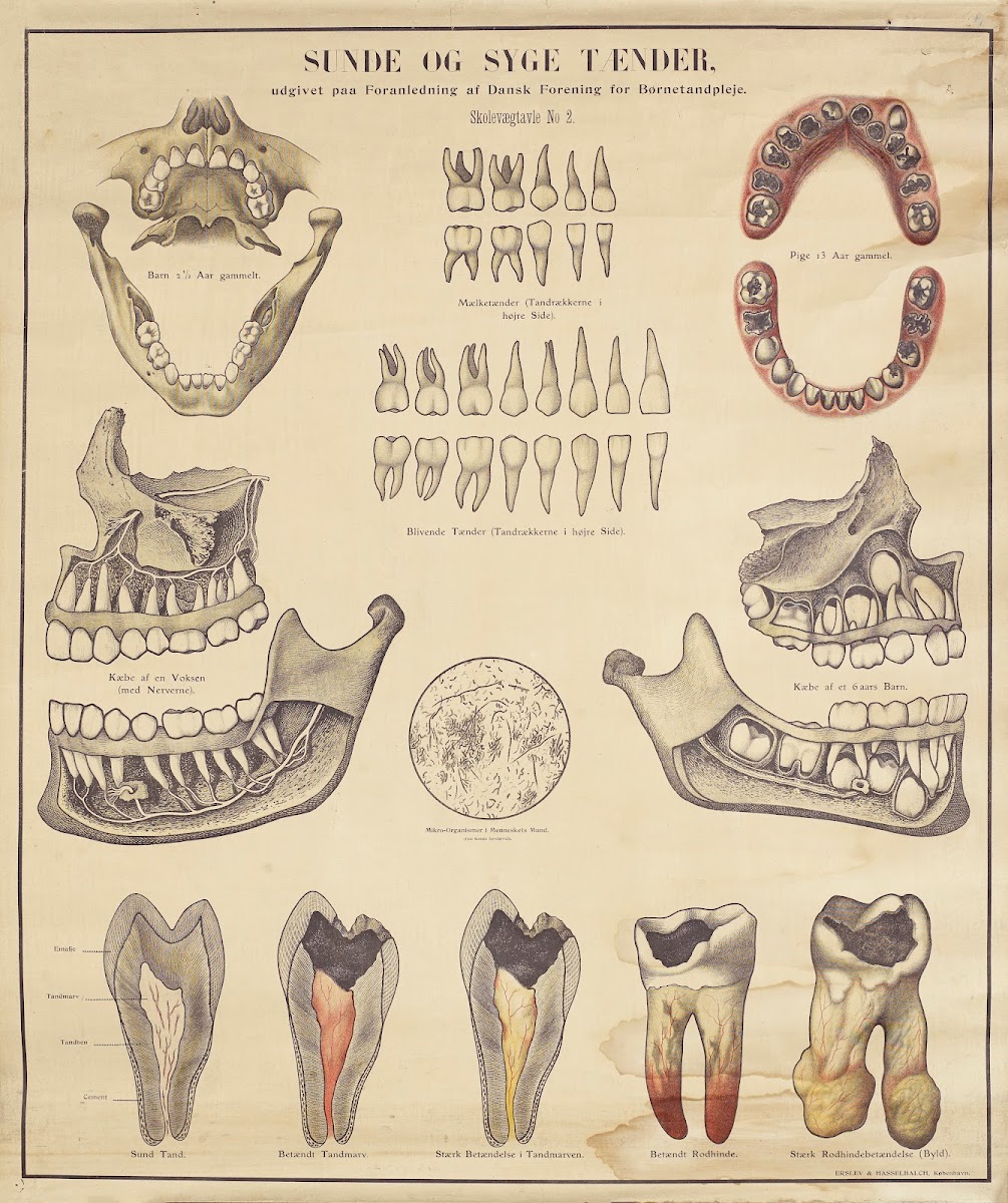 Healthy And Unhealthy Teeth 1910