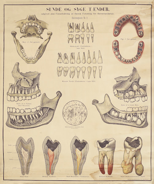 Healthy And Unhealthy Teeth 1910