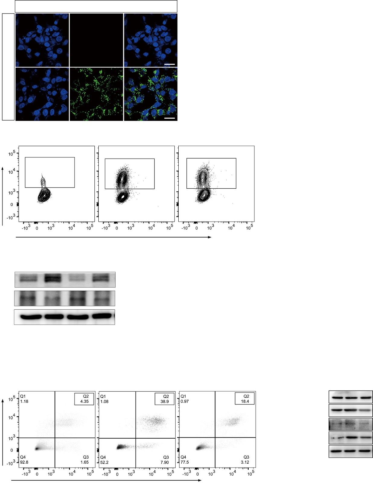 Inhalation of Mesenchymal Stromal Cell-Derived Extracellular Vesicles Activates Macrophage Polarization through the miR-22-3p/NLRP3/IL-1β Pathway, Ameliorating Lung Ischemia-Reperfusion Injury