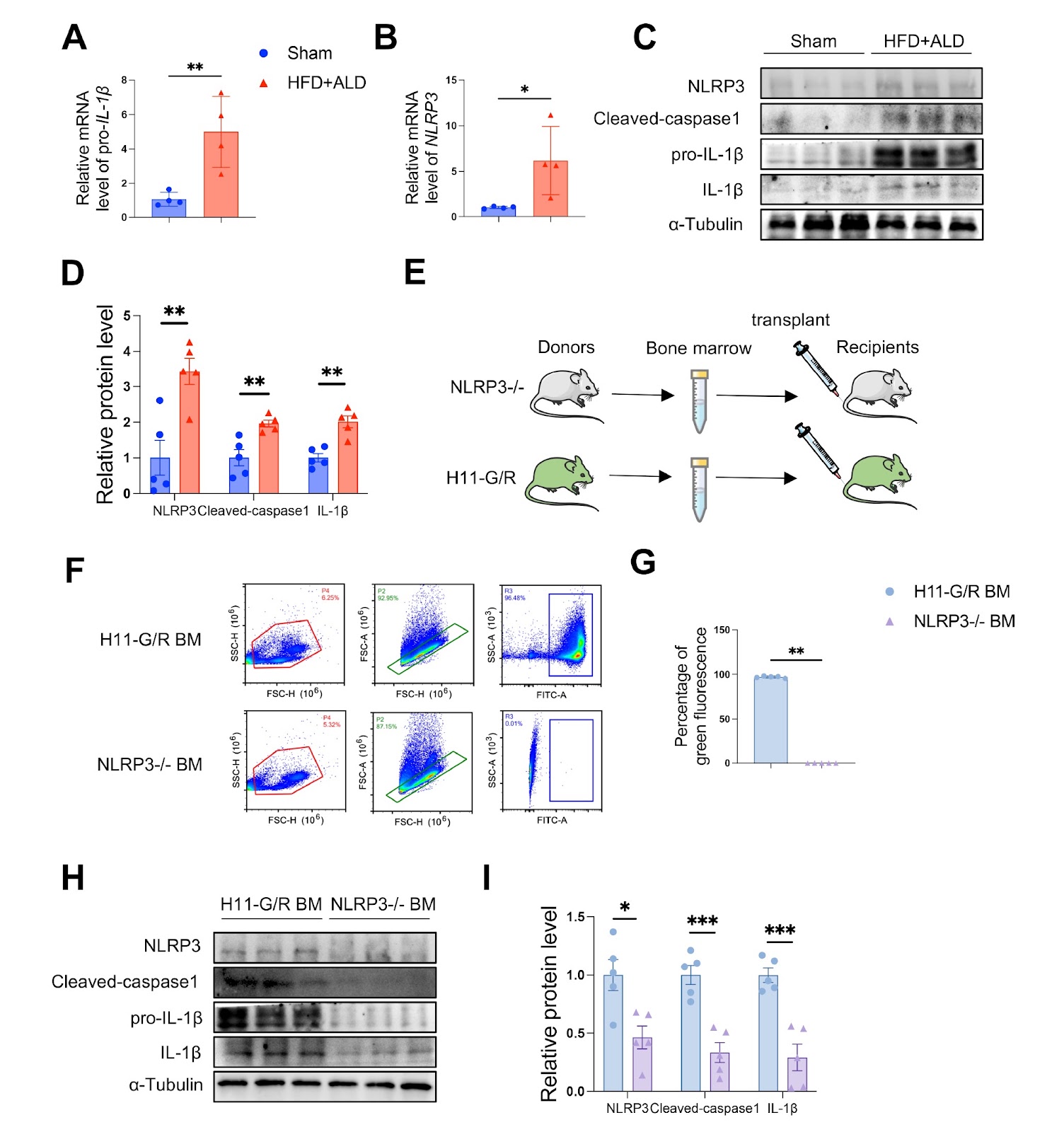 Macrophage NLRP3-dependent IL-1β production contributes to aortic fibrosis in heart failure with preserved ejection fraction