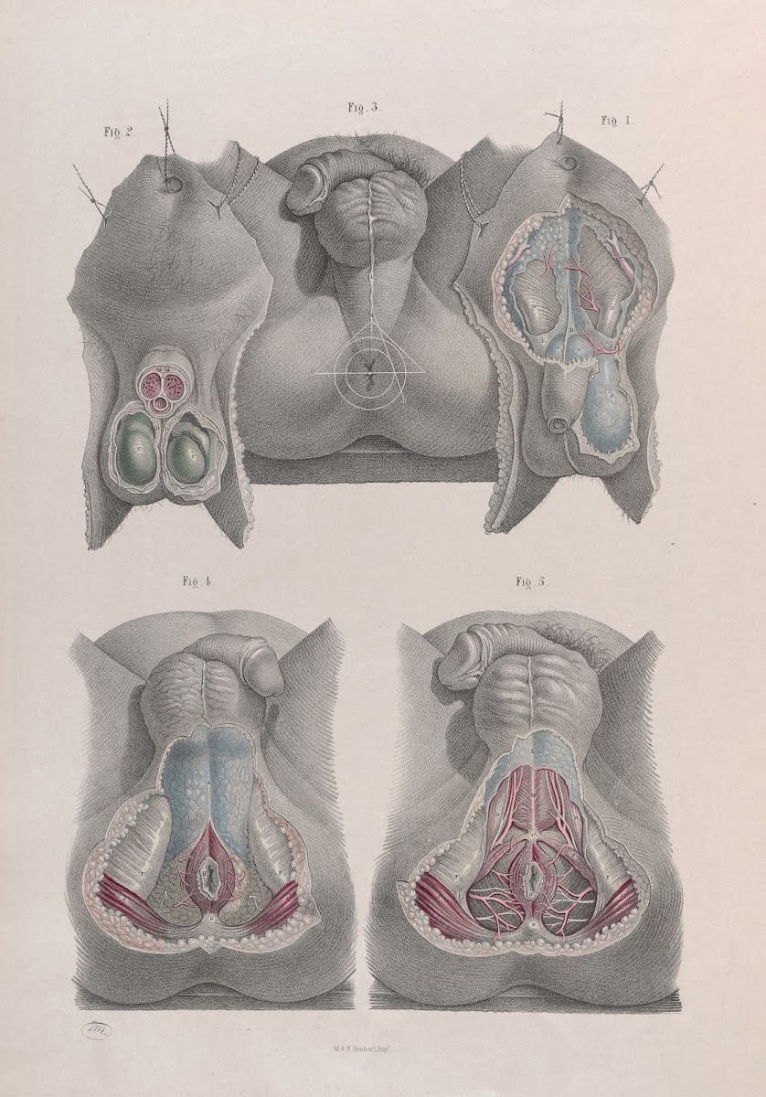 Surgical anatomy Pl42 1856