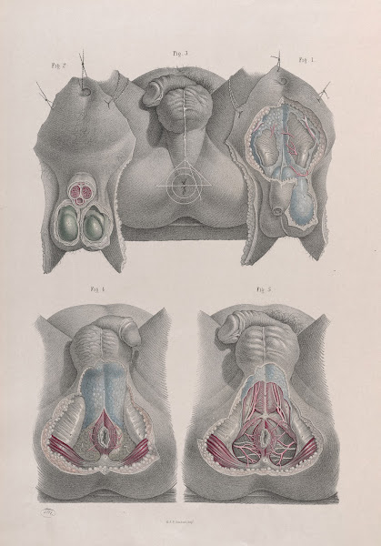 Surgical anatomy Pl42 1856