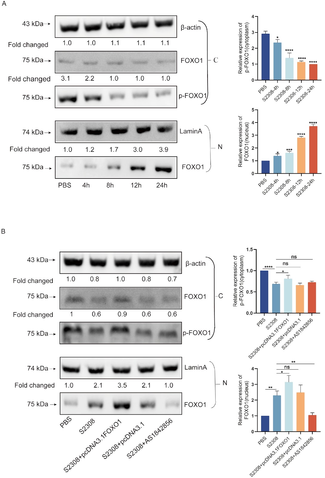Brucella secretory protein VceA promotes FOXO1 entry into the nucleus to shift host cell metabolism toward glycolysis