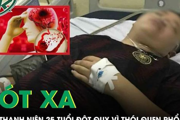 Xót xa: Nam thanh niên 25 tuổi đột quỵ vì thói quen phổ biến giới trẻ - Báo Sức Khỏe &amp; Đời Sống