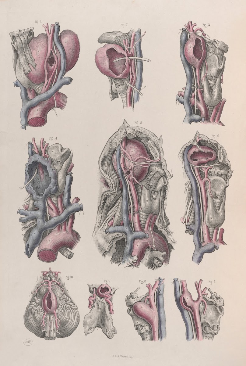 Surgical anatomy Pl17 1856