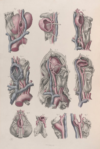 Surgical anatomy Pl17 1856