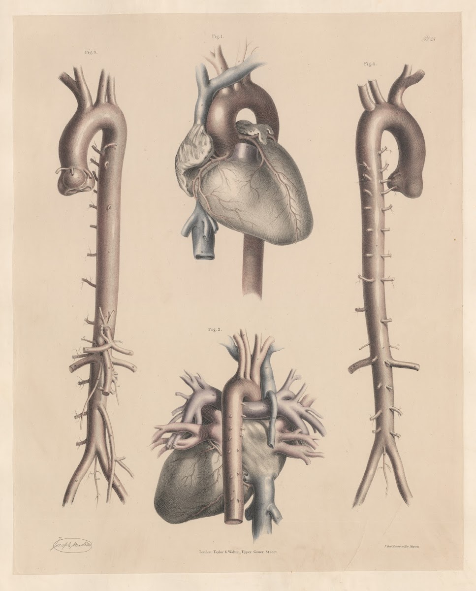 The entire of the Aorta with the branches springing from it The Heart and the Ve