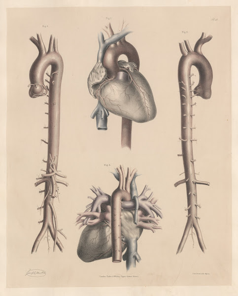 The entire of the Aorta with the branches springing from it The Heart and the Ve