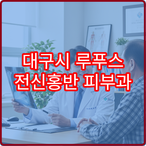 대구시 루푸스 전신홍반 피부과 류마티스내과 면역치료 병원