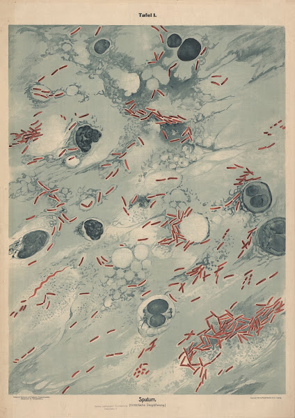 Sputum 1912