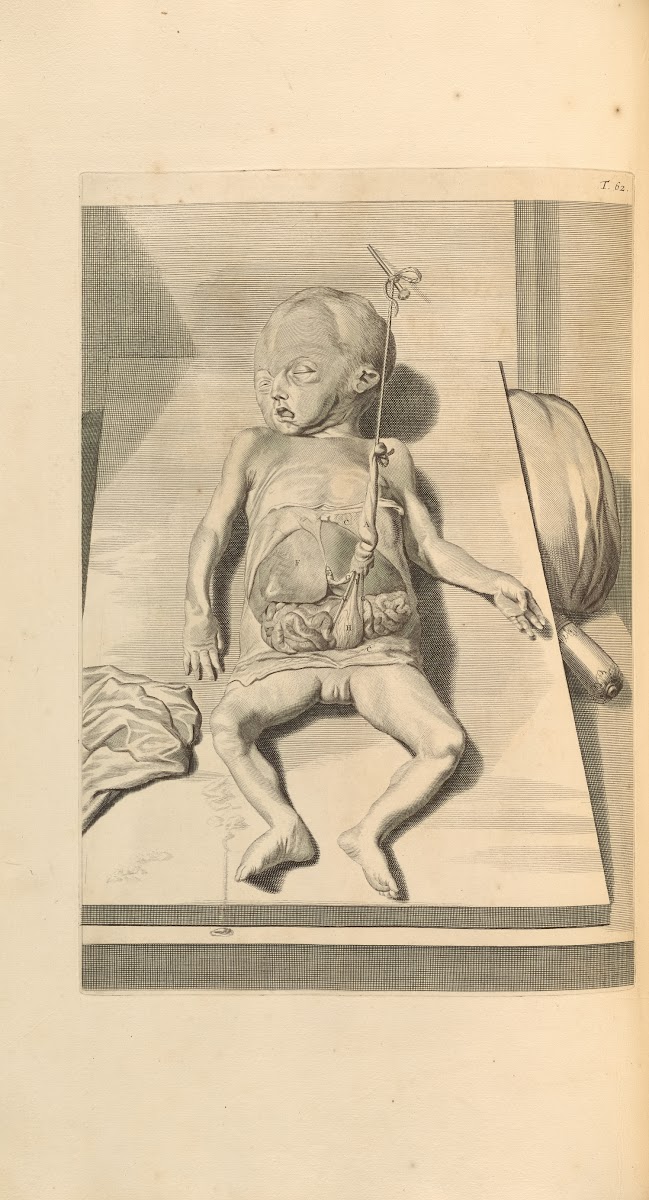 Anatomia humani corporis Pl063 1685