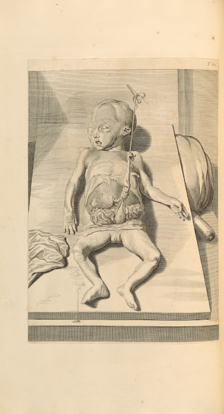 Anatomia humani corporis Pl063 1685