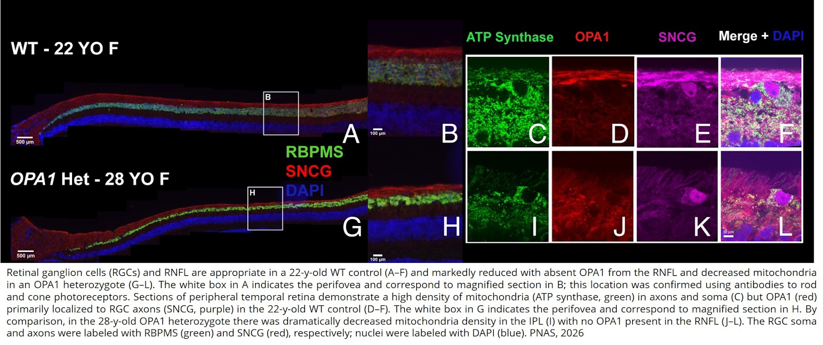 Rhesus macaques with an OPA1 mutation demonstrate features of autosomal dominant optic atrophy