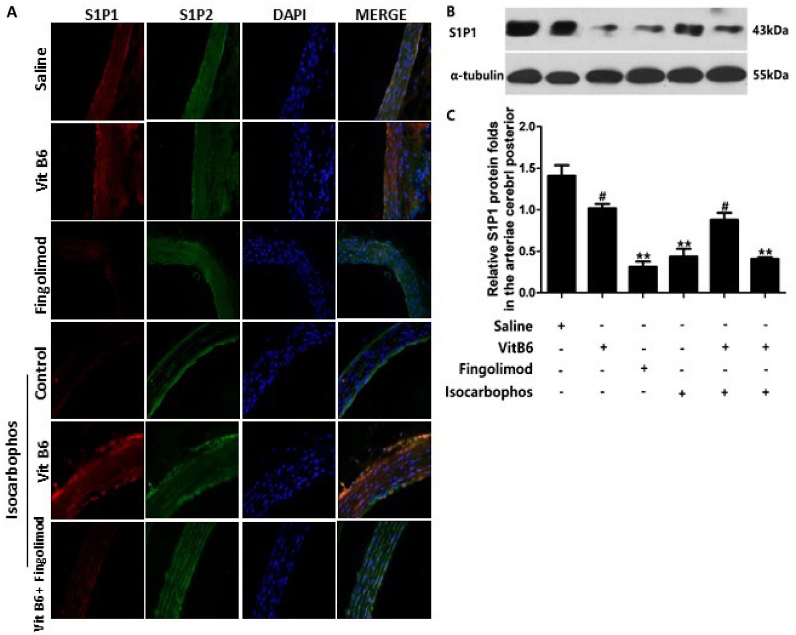 Corrigendum to: Vitamin B6 prevents Isocarbophos-induced posterior cerebral artery injury in offspring rats through up-regulating S1P receptor expression