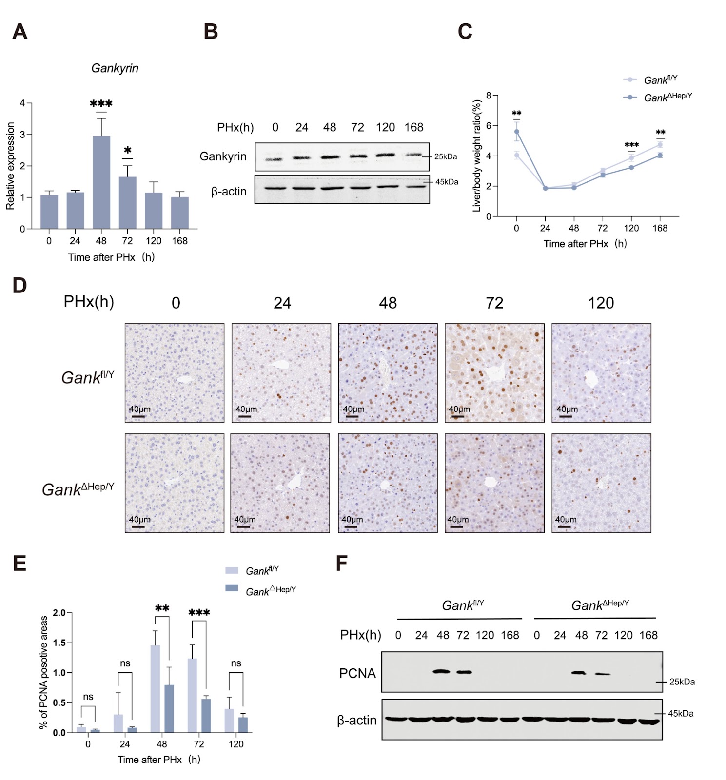 Gankyrin-deficiency reprograms intrahepatic glucose and lipid metabolism to delay liver regeneration