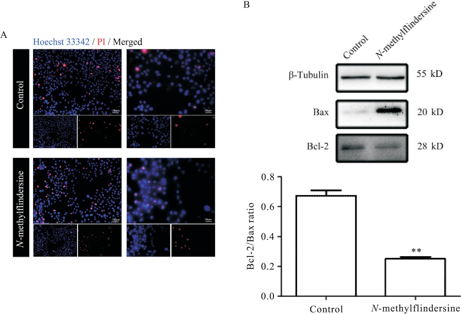 Induction of apoptosis and autophagy in human glioblastoma cells by N-methylflindersine: insights into regulatory role of ERK pathway