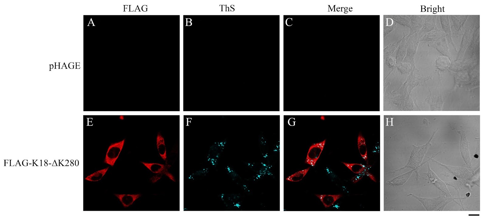 Construction of a cell-based aggregation and seeding model for the Tau protein