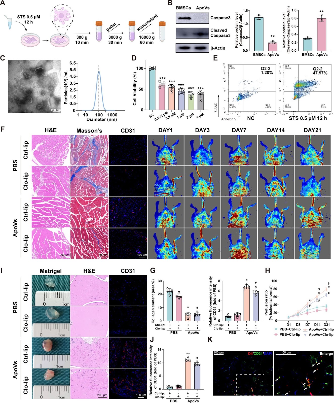 Apoptotic vesicles derived from bone marrow mesenchymal stem cells increase angiogenesis in a hind limb ischemia model via the NAMPT/SIRT1/FOXO1 axis