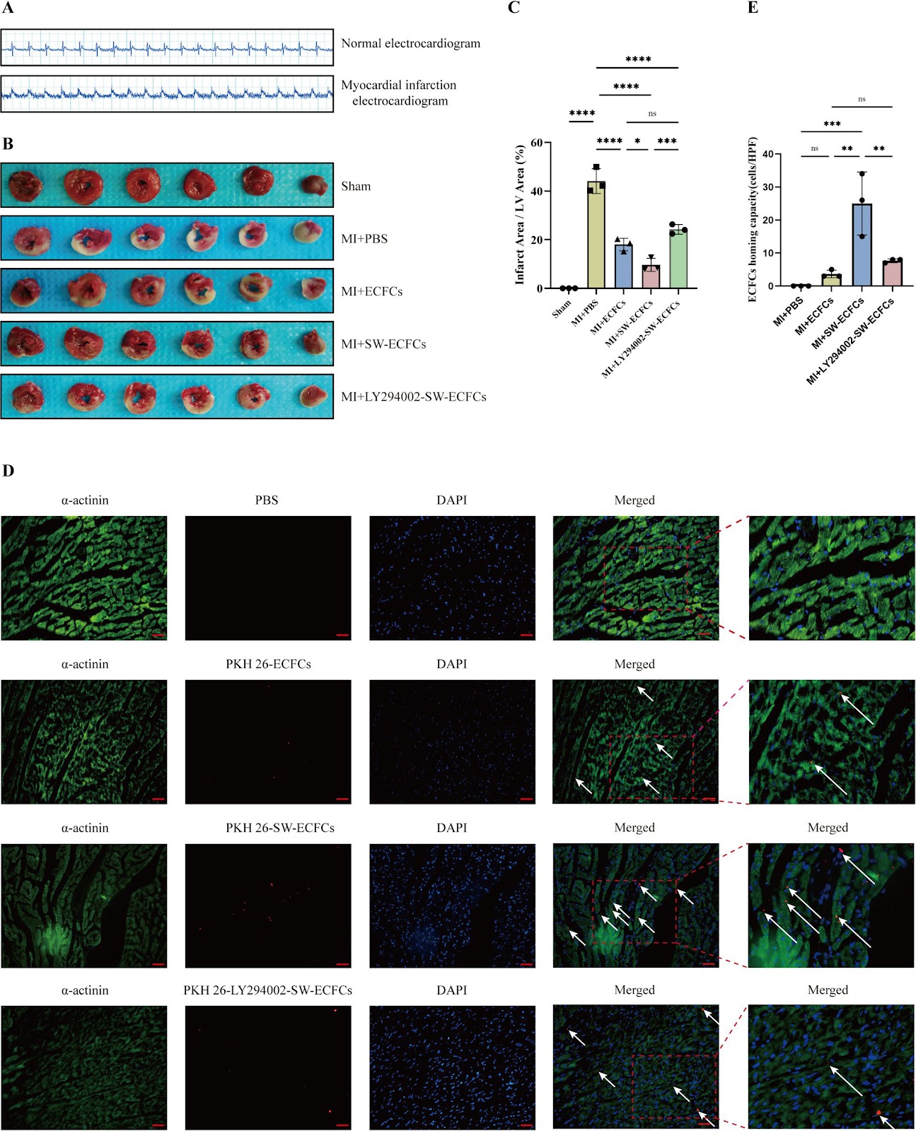 Extracorporeal cardiac shock wave stimulation enhances the therapeutic efficacy of intravenously delivered endothelial colony-forming cells via PI3K/AKT signaling in a rat myocardial infarction model