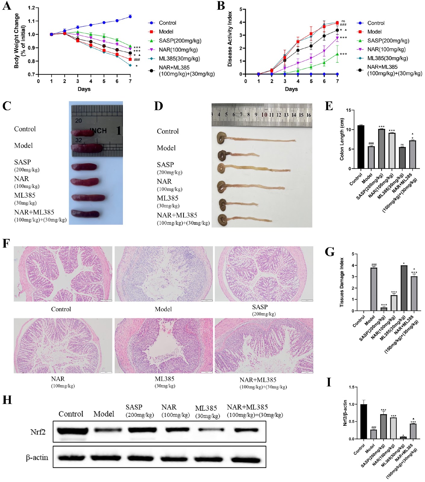 The protective effect of naringenin on ulcerative colitis in mice through increasing Nrf2 pathway activity