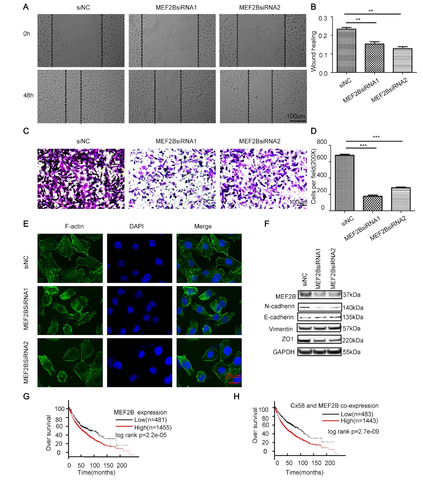 Cx58 is associated with the metastasis of non-small cell lung cancer via MEF2B/Cx58 axis