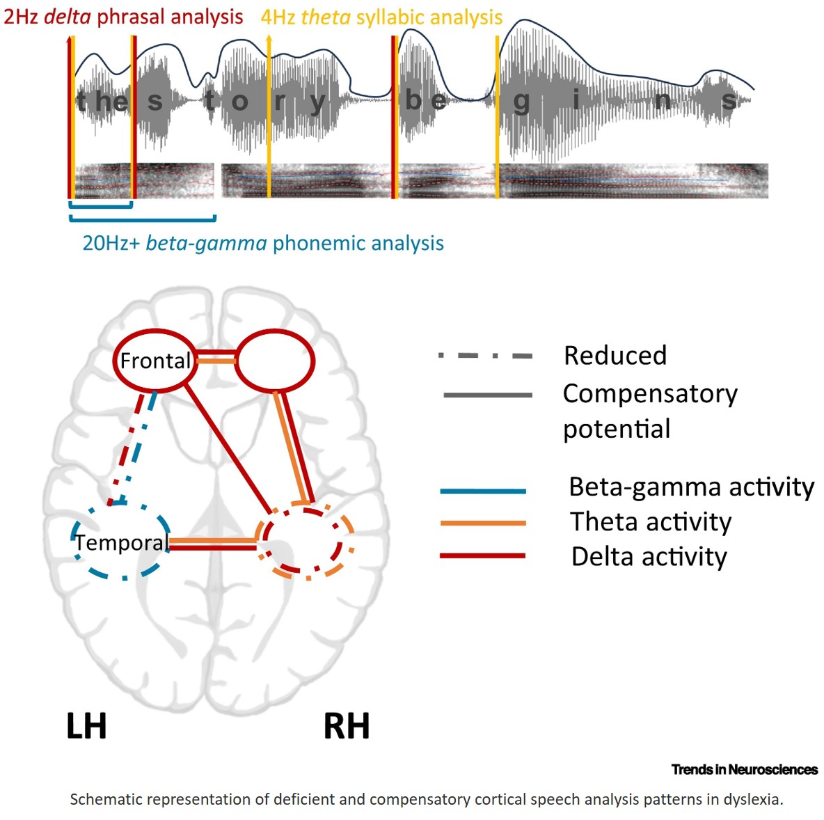 Dyslexia: a window into the cortical mechanisms of adaptive speech analysis