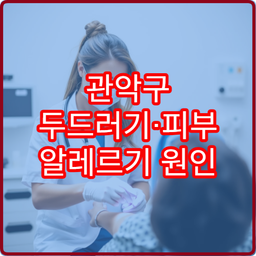 관악구 두드러기·피부 알레르기 원인 검사 및 치료 병원 안내