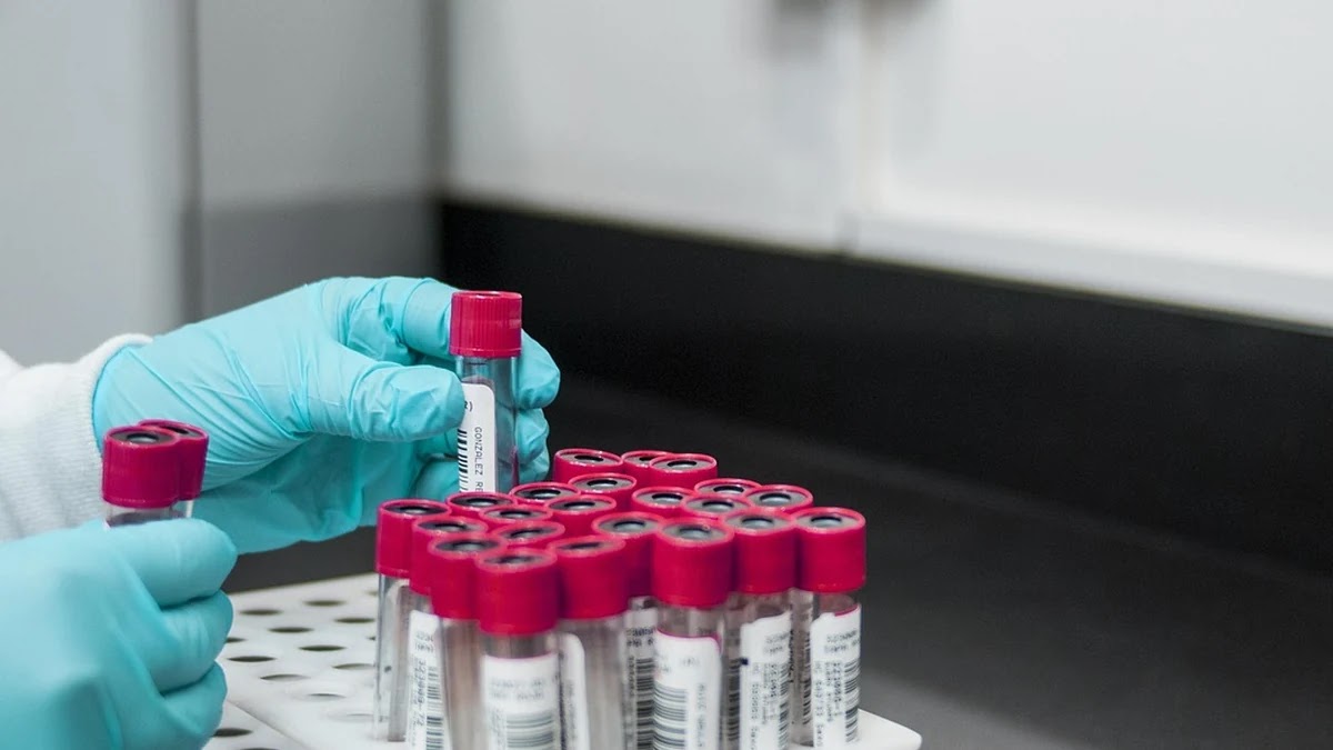 간수치 ALT와 AST 상승 원인별 맞춤 식품과 관리법